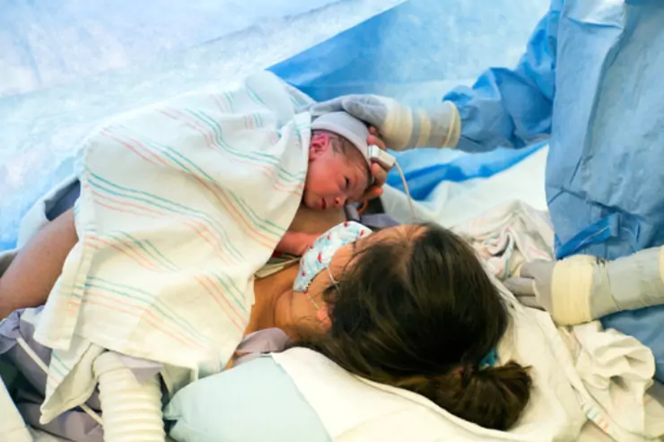 Cesarean Section (C-Section)